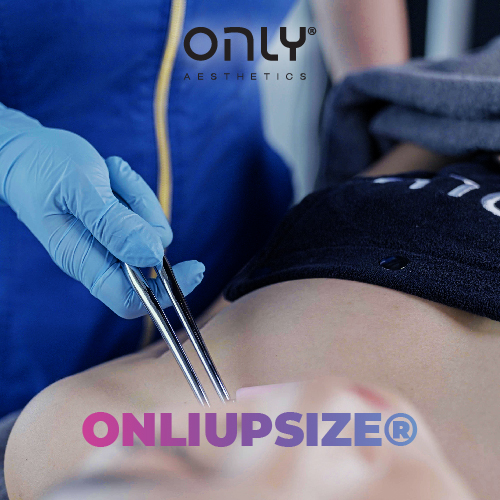 ONLY Aesthetics ONLiUpsize Breast Enhancement Treatment Trial [Redeem in Stores]