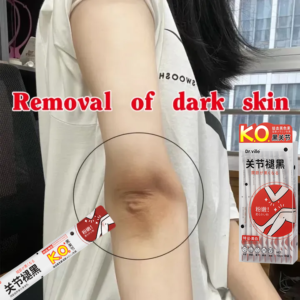 14 Days Remove Black Dead Skin Niacinamide Whitening Cream Massage Cream Elbow, Knee, Ankle, Neck, Underarm and Hip Melanin Cream Remover 10ML*10